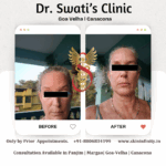 Botox and dermal fillers at Dr Swati's Aesthetic clinic