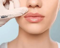 full face non invasive dermal fillers at Dr. Swati's clinic ,dermal fillers Goa