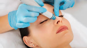 hydra-facial treatment for deep cleansing at Dr. Swatis Clinic, HydraFacial Goa