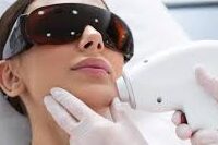permanent hair removal goa