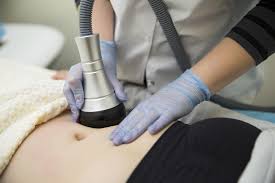 laser lypolysis at Dr. Swati's Clinic. laser lipolysis Goa