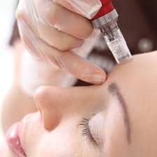 microneedling treatment at Dr. Swati's Clinic .microneedling for acne scars goa