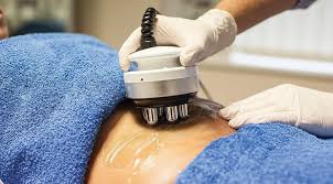 radiofrequency treatment , non-surgical fat loss Goa