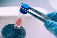 stem cell