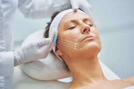 advanced thread lift treatment . non-invasive thread lifts goa