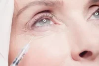under eye filler