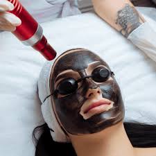 carbon facial