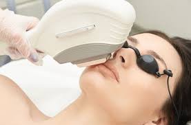 ipl facial