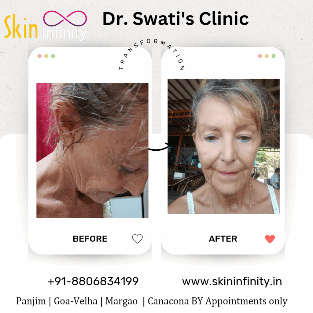 www.skininfinity.in_202409