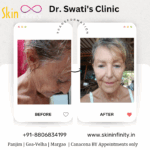 www.skininfinity.in_202409