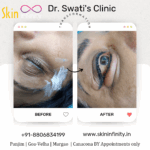 www.skininfinity.in_20240