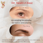 Dr Swati's aesthetic before after 67