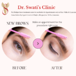 Dr Swati's aesthetic before after 66