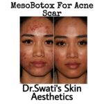 Dr Swati's aesthetic before after 65