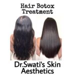 Dr Swati's aesthetic before after 64