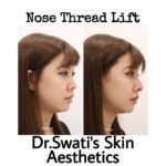 Dr Swati's aesthetic before after 63