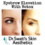 Dr Swati's aesthetic before after 60