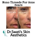 Dr Swati's aesthetic before after 57