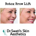 Dr Swati's aesthetic before after 51