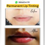 Dr Swati's aesthetic before after 50