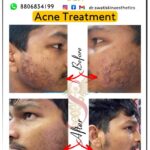 Dr Swati's aesthetic before after 48