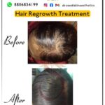 Dr Swati's aesthetic before after 46