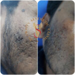 Dr Swati's aesthetic before after 41