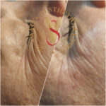 Dr Swati's aesthetic before after 38