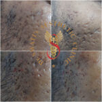 Dr Swati's aesthetic before after 37