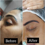 Dr Swati's aesthetic before after 36
