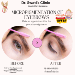 Dr Swati's aesthetic before after 33