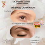 Dr Swati's aesthetic before after 32
