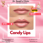 Dr Swati's aesthetic before after 30