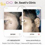Dr Swati's aesthetic before after 35