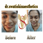 Dr Swati's aesthetic before after 27