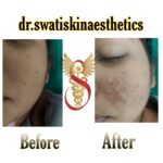 Dr Swati's aesthetic before after 25
