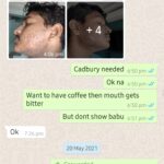 Dr Swati's aesthetic before after 21