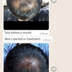 Dr Swati's aesthetic before after 20