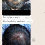 Dr Swati's aesthetic before after 18