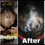 Dr Swati's aesthetic before after 14