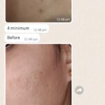Dr Swati's aesthetic before after 13
