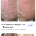 Dr Swati's aesthetic before after 12