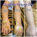 Dr Swati's aesthetic before after 11