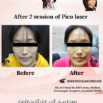 Dr Swati's aesthetic before after 10