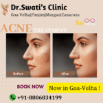 Dr Swati's aesthetic before after 9