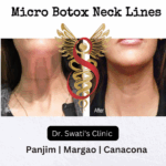 Dr Swati's aesthetic before after 24