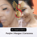 Dr Swati's aesthetic before after 23