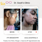 Dr Swati's aesthetic before after 3
