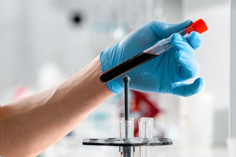Blood Test In Canacona