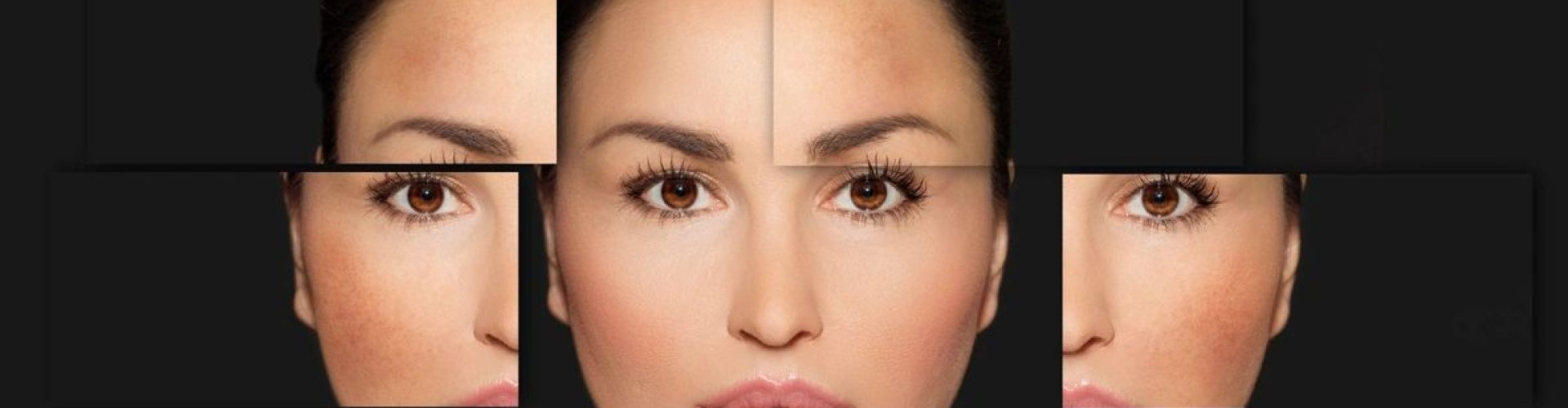 Dermal fillers at Dr. Swati's Aesthetic Clinic
